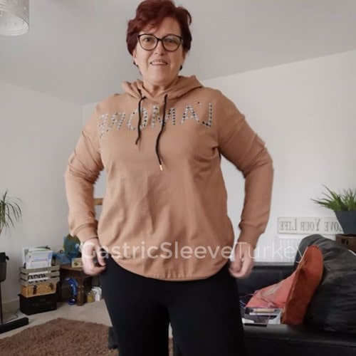 Weight Loss Surgery: Gastric Sleeve Joanna C. Review