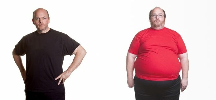 Gastric Sleeve 10 Years Later