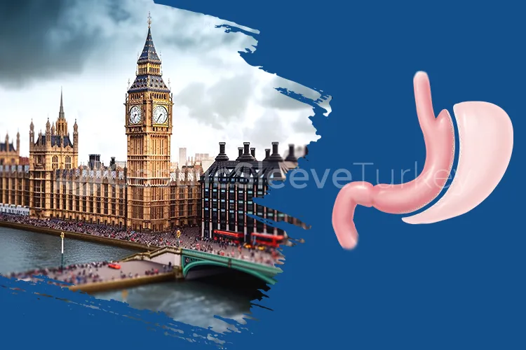 Gastric Sleeve UK Private