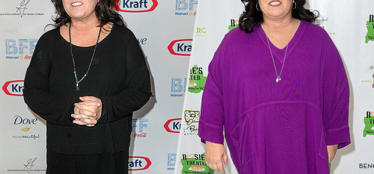 Rosie O’Donnell’s Gastric Sleeve Surgery in 5 Important Steps