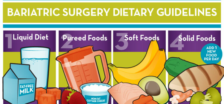 Diet Before Gastric Sleeve Surgery