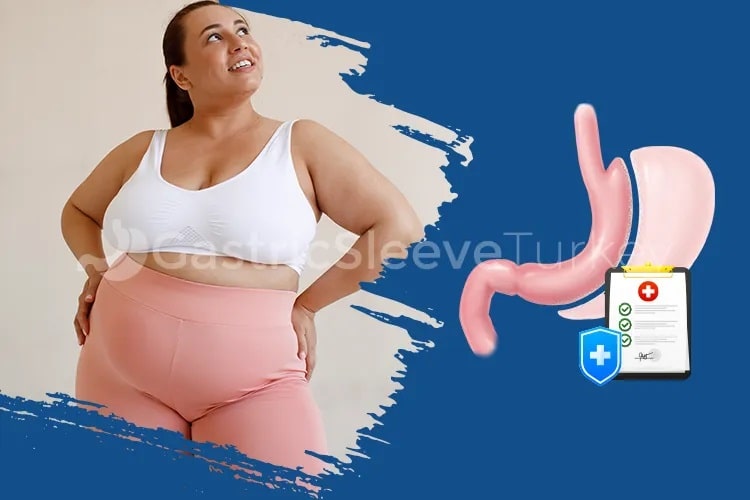 Pros and Cons of Gastric Sleeve