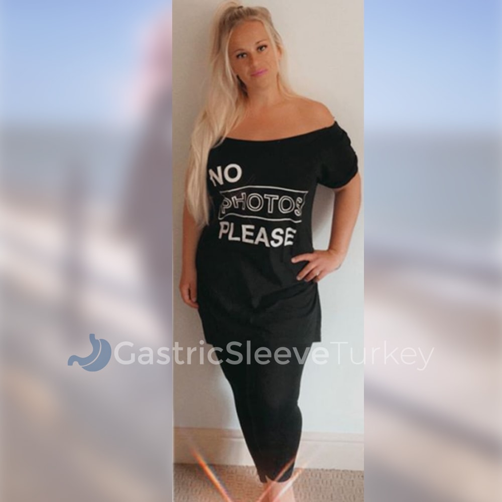 becky-6-months-after-gastric-sleeve