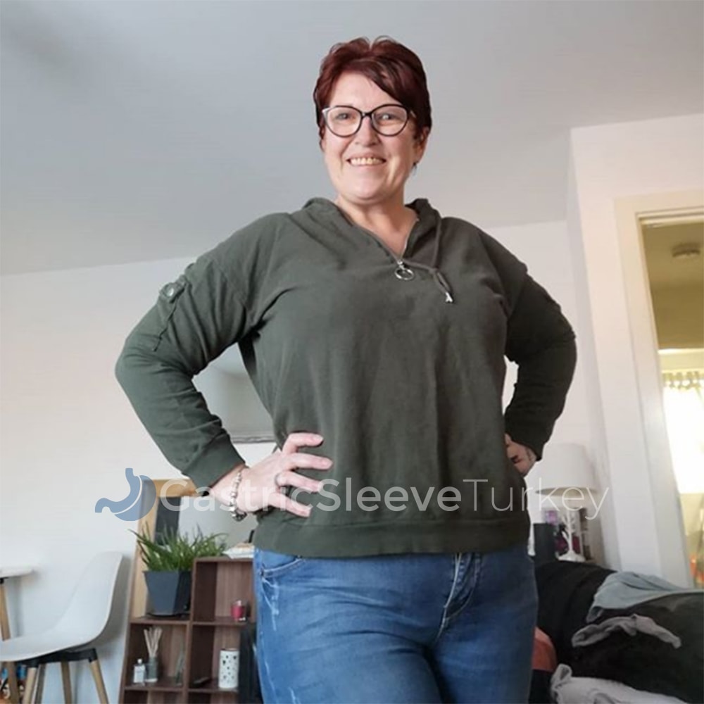 jo-after-1-months-gastric-sleeve