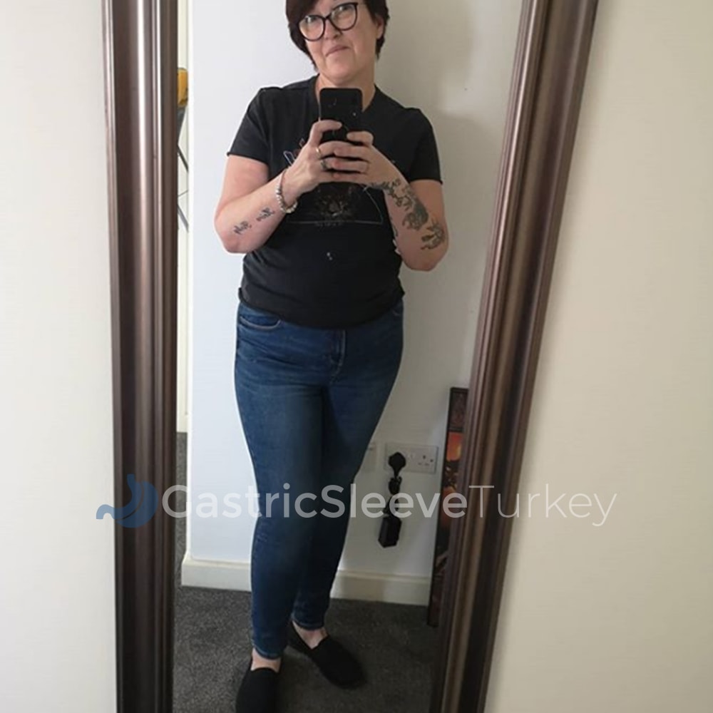 jo-after-3-months-gastric-sleeve