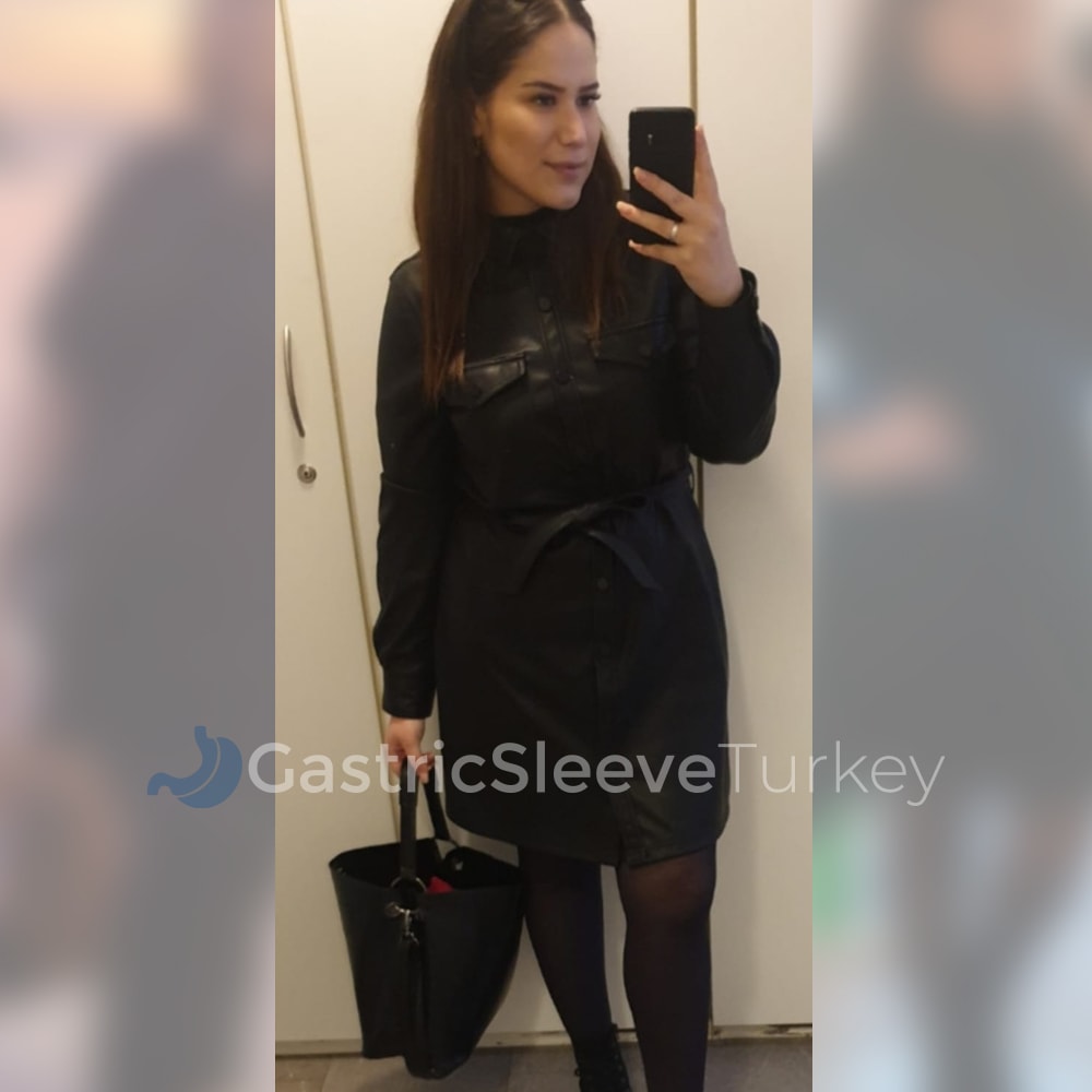 sumeyye-after-4-months-gastric-sleeve
